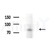 HNRNPR Antibody - Western blot analysis of extracts from Mouse liver, using HNRNPR Antibody at 1/1000 dilution.