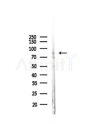 HNRNPR Antibody - Western blot analysis of lysates from Mouse liver, using HNRNPR Antibody at 1/1000 dilution.