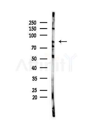 HNRNPR Antibody - Western blot analysis of lysates from B16F10-LUC cells(LPS,4h treatment), using HNRNPR Antibody at 1/1000 dilution.