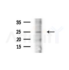 HOP2 Antibody - Western blot analysis of extracts from A375 cells(heat-shock,45min treatment), using HOP2 Antibody at 1/1000 dilution.