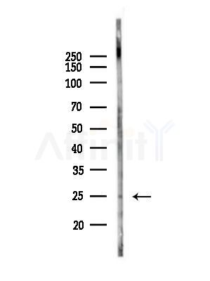 HOP2 Antibody - Western blot analysis of lysates from A375 cells(heat-shock,45min treatment), using HOP2 Antibody at 1/1000 dilution.