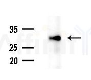HOXC4 Antibody - Western blot analysis of extracts from Mouse liver, using HOXC4 Antibody at 1/1000 dilution.