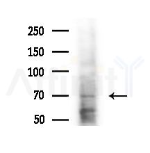 HP1BP3 Antibody - Western blot analysis of extracts from Mouse liver, using HP1BP3 Antibody at 1/1000 dilution.