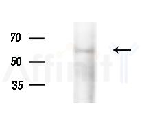 HSPA13 Antibody - Western blot analysis of extracts from PC12 cells(starvation treatment), using HSPA13 Antibody at 1/1000 dilution.