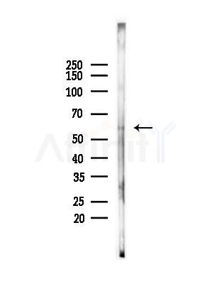HSPA13 Antibody - Western blot analysis of lysates from PC12 cells(starvation treatment), using HSPA13 Antibody at 1/1000 dilution.