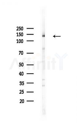 HTATSF1 Antibody - Western blot analysis of lysates from A375 cells(heat-shock,45min treatment), using HTATSF1 Antibody at 1/1000 dilution.