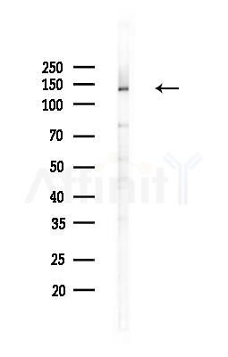 HTATSF1 Antibody - Western blot analysis of lysates from MCF7 cells(heat-shock,45min treatment), using HTATSF1 Antibody at 1/1000 dilution.