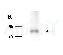 IDI1 Antibody - Western blot analysis of extracts from various samples, using IDI1 Antibody at 1/1000 dilution.