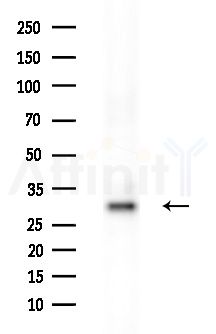 IDI1 Antibody - Western blot analysis of extracts from PC12 cells(starvation treatment), using IDI1 Antibody at 1/1000 dilution.