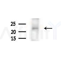IFT27 Antibody - Western blot analysis of extracts from Hela cells(heat-shock,45min treatment), using IFT27 Antibody at 1/1000 dilution.