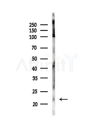 IFT27 Antibody - Western blot analysis of lysates from Hela cells(heat-shock,45min treatment), using IFT27 Antibody at 1/1000 dilution.