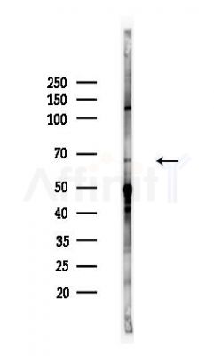 IL1RAPL1 Antibody - Western blot analysis of lysates from A375 cells(heat-shock,45min treatment), using IL1RAPL1 Antibody at 1/1000 dilution.