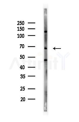 IL1RAPL1 Antibody - Western blot analysis of lysates from MCF7 cells(heat-shock,45min treatment), using IL1RAPL1 Antibody at 1/1000 dilution.