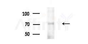 INPP5B Antibody - Western blot analysis of extracts from A375 cells(heat-shock treatment), using INPP5B Antibody at 1/1000 dilution.