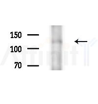 IWS1 Antibody - Western blot analysis of extracts from Rat brain, using IWS1 Antibody at 1/1000 dilution.