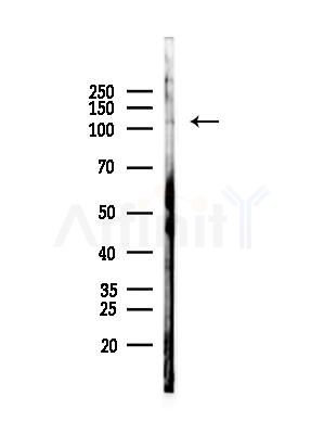 IWS1 Antibody - Western blot analysis of lysates from Rat brain, using IWS1 Antibody at 1/1000 dilution.