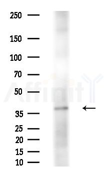 KCNAB2 Antibody - Western blot analysis of extracts from Rat liver, using KCNAB2 Antibody at 1/1000 dilution.