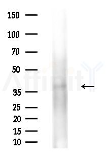 KCNAB2 Antibody - Western blot analysis of extracts from Mouse brain, using KCNAB2 Antibody at 1/1000 dilution.