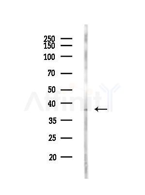 KCNAB2 Antibody - Western blot analysis of lysates from Rat liver, using KCNAB2 Antibody at 1/1000 dilution.