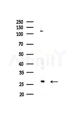 KCNE4 Antibody - Western blot analysis of lysates from MCF7 cells(heat-shock,45min treatment), using KCNE4 Antibody at 1/1000 dilution.