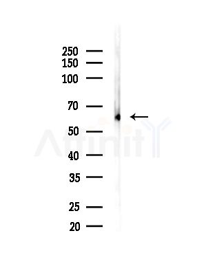 KLC2 Antibody - Western blot analysis of lysates from Mouse testis, using KLC2 Antibody at 1/1000 dilution.