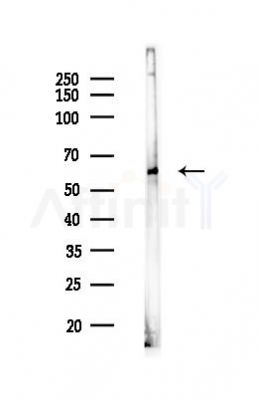 KLHL18 Antibody - Western blot analysis of lysates from Mouse testis, using KLHL18 Antibody at 1/1000 dilution.