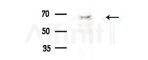 KRBP Antibody - Western blot analysis of extracts from Rat brain, using KRBP Antibody at 1/1000 dilution.