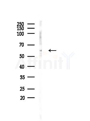 KRBP Antibody - Western blot analysis of lysates from Rat brain, using KRBP Antibody at 1/1000 dilution.