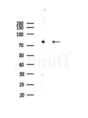 Kv1.3/KCNA3 Antibody - Western blot analysis of lysates from HUVEC cells(LPS,4h treatment), using Kv1.