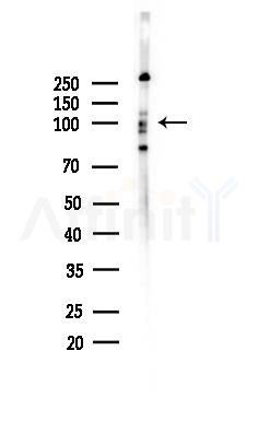 LARS2 Antibody - Western blot analysis of lysates from HepG2 cells(starvation,24h treatment), using LARS2 Antibody at 1/1000 dilution.