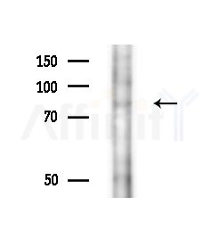 LAS1L Antibody - Western blot analysis of extracts from Rat brain, using LAS1L Antibody at 1/1000 dilution.