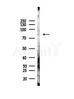 LAS1L Antibody - Western blot analysis of lysates from Rat brain, using LAS1L Antibody at 1/1000 dilution.
