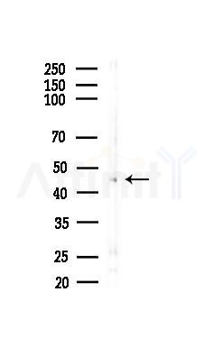 LASS2 Antibody - Western blot analysis of lysates from HepG2 cells(starvation,24h treatment), using LASS2 Antibody at 1/1000 dilution.