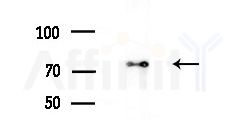 LENG8 Antibody - Western blot analysis of extracts from Rat brain, using LENG8 Antibody at 1/1000 dilution.