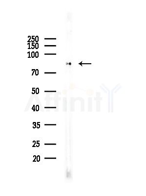 LENG8 Antibody - Western blot analysis of lysates from Rat brain, using LENG8 Antibody at 1/1000 dilution.