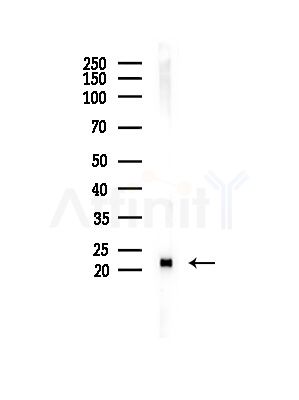 LOH12CR1 Antibody - Western blot analysis of lysates from Rat liver, using LOH12CR1 Antibody at 1/1000 dilution.