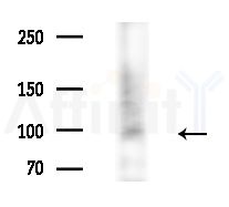 MACC1 Antibody - Western blot analysis of extracts from A375 cells(heat-shock,45min treatment), using MACC1 Antibody at 1/1000 dilution.