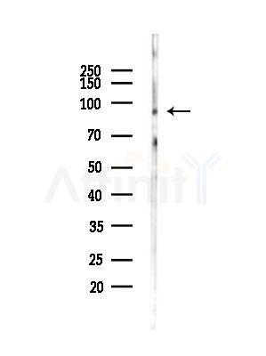 MACC1 Antibody - Western blot analysis of lysates from A375 cells(heat-shock,45min treatment), using MACC1 Antibody at 1/1000 dilution.