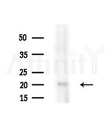 MED10 Antibody - Western blot analysis of extracts from Rat brain, using MED10 Antibody at 1/1000 dilution.