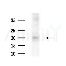 MED10 Antibody - Western blot analysis of extracts from Mouse testis, using MED10 Antibody at 1/1000 dilution.