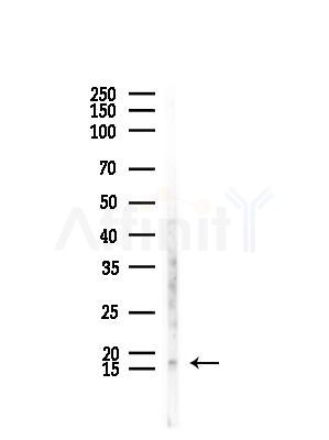 MED10 Antibody - Western blot analysis of lysates from Mouse testis, using MED10 Antibody at 1/1000 dilution.