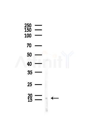 MED10 Antibody - Western blot analysis of lysates from Rat brain, using MED10 Antibody at 1/1000 dilution.