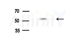 MGAT4C Antibody - Western blot analysis of extracts from Rat brain, using MGAT4C Antibody at 1/1000 dilution.