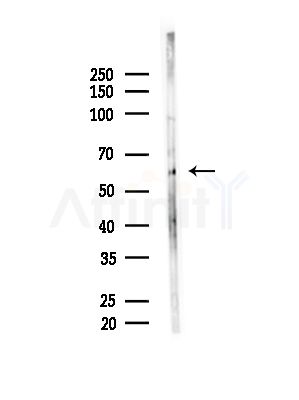 MRPP3 Antibody - Western blot analysis of lysates from MCF7 cells(heat-shock,45min treatment), using MRPP3 Antibody at 1/1000 dilution.