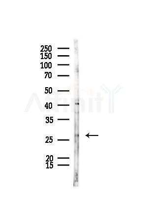 MSRA Antibody - Western blot analysis of lysates from HepG2 cells(starvation,24h treatment), using MSRA Antibody at 1/1000 dilution.