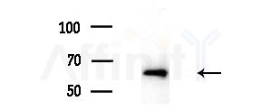 MYEOV Antibody - Western blot analysis of extracts from Rat brain, using MYEOV Antibody at 1/1000 dilution.