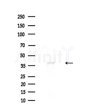 MYLK4 Antibody - Western blot analysis of extracts from Rat brain, using MYLK4 Antibody at 1/1000 dilution.