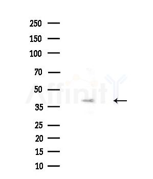 MYLK4 Antibody - Western blot analysis of extracts from Mouse liver, using MYLK4 Antibody at 1/1000 dilution.