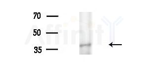 MYLK4 Antibody - Western blot analysis of extracts from A375 cells(heat-shock treatment), using MYLK4 Antibody at 1/1000 dilution.