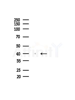 MYLK4 Antibody - Western blot analysis of lysates from Mouse liver, using MYLK4 Antibody at 1/1000 dilution.